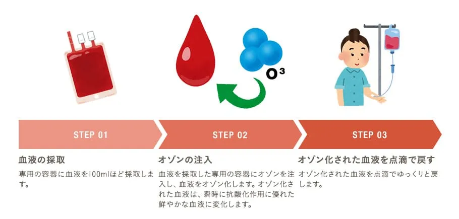 オゾン療法の流れ STEP01 血液の採取／STEP02 オゾンの注入／STEP03 オゾン化された血液を点滴で戻す