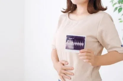 出生前診断の画像