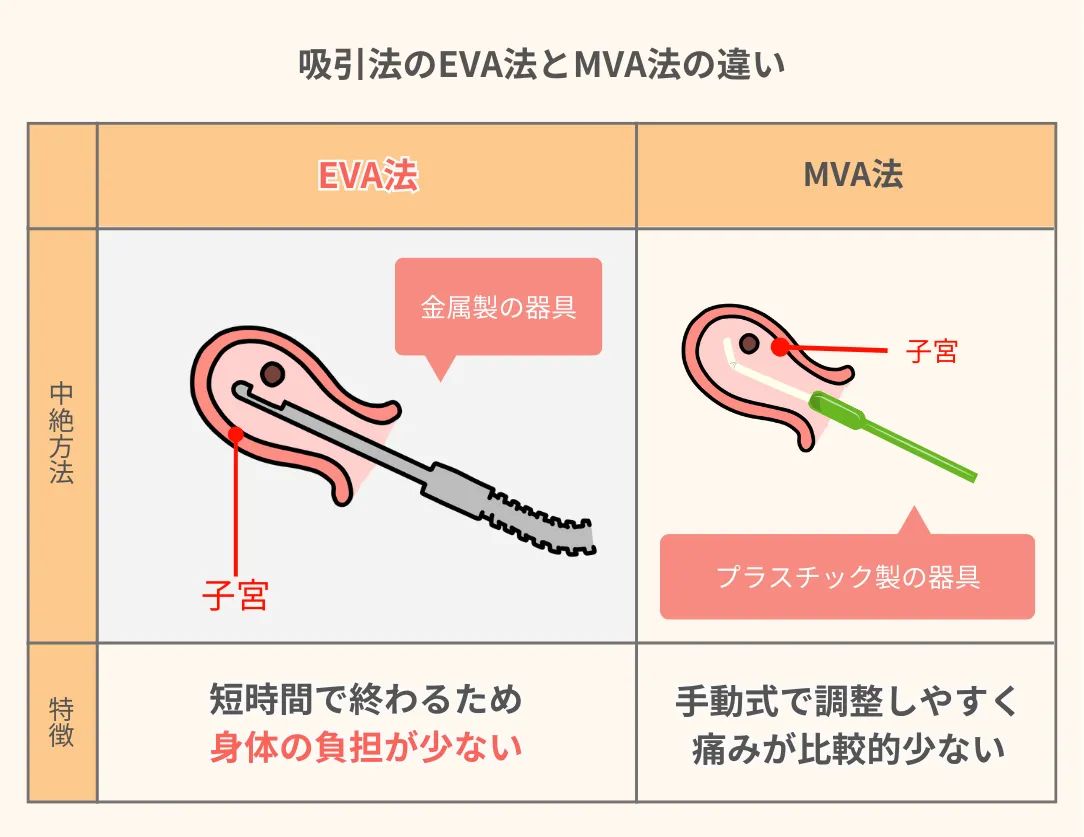 電動吸引法（EVA法）のイラスト