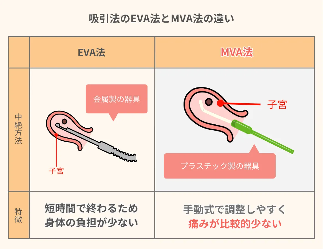 手動真空吸引法（MVA法）のイラスト